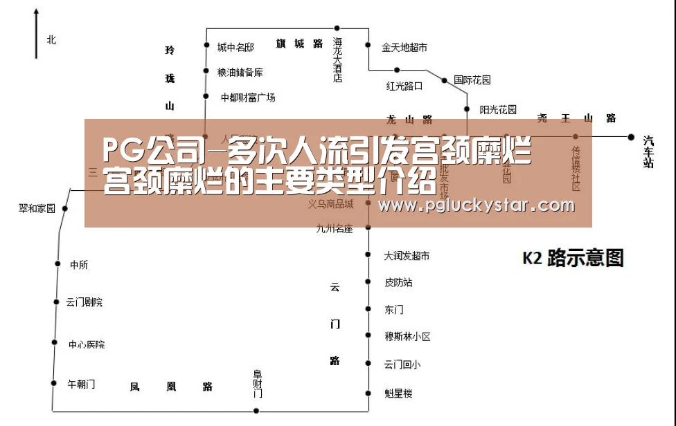 PG公司-多次人流引发宫颈糜烂 宫颈糜烂的主要类型介绍(图4) PG直播