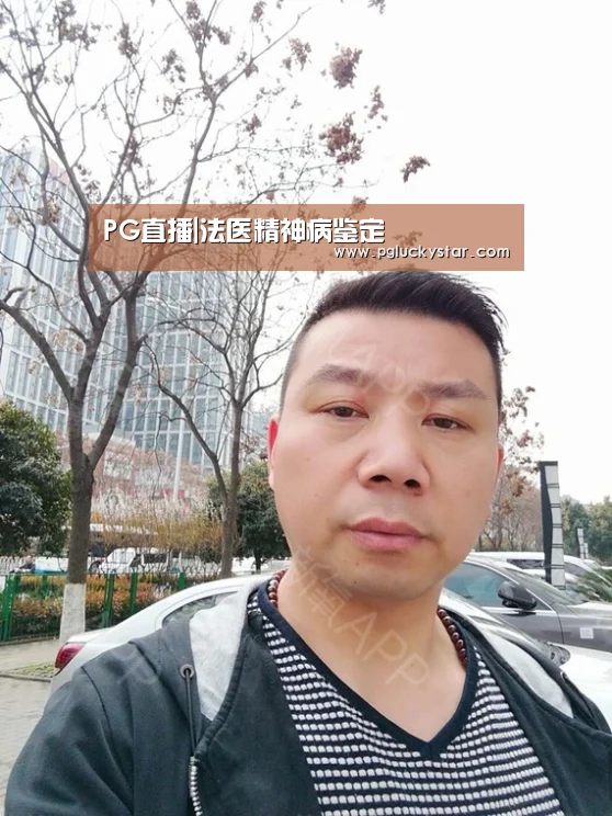 PG直播|法医精神病鉴定(图1) PG模拟器